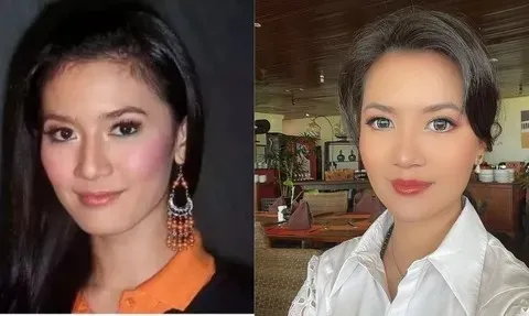 15 potret wajah seleb oplas dagu © 2025 brilio.net