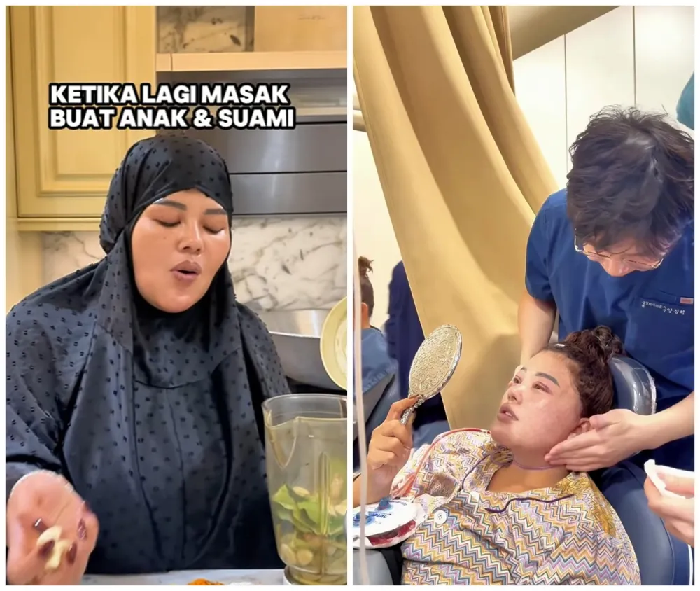 Shindy Samuel sebelum dan sesudah operasi plastik © Instagram Shindy Samuel sebelum dan sesudah operasi plastik © Instagram