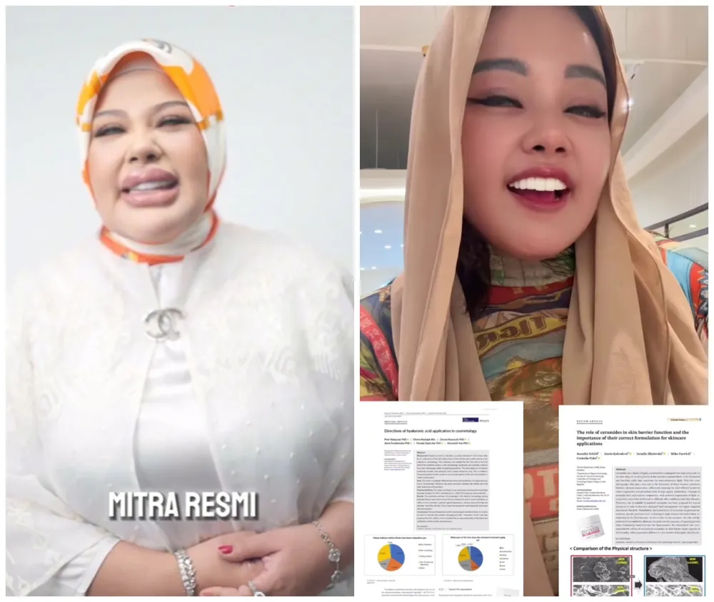 Shindy Samuel sebelum dan sesudah operasi plastik © Instagram Shindy Samuel sebelum dan sesudah operasi plastik © Instagram