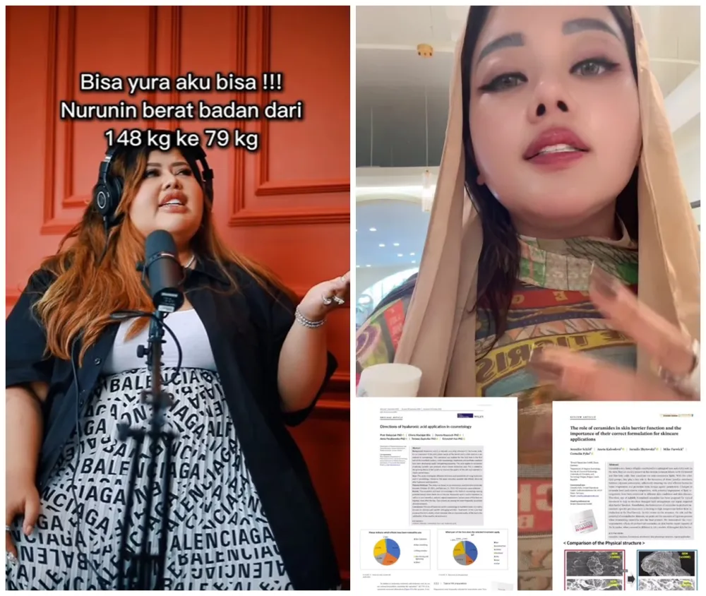 Shindy Samuel sebelum dan sesudah operasi plastik © Instagram Shindy Samuel sebelum dan sesudah operasi plastik © Instagram