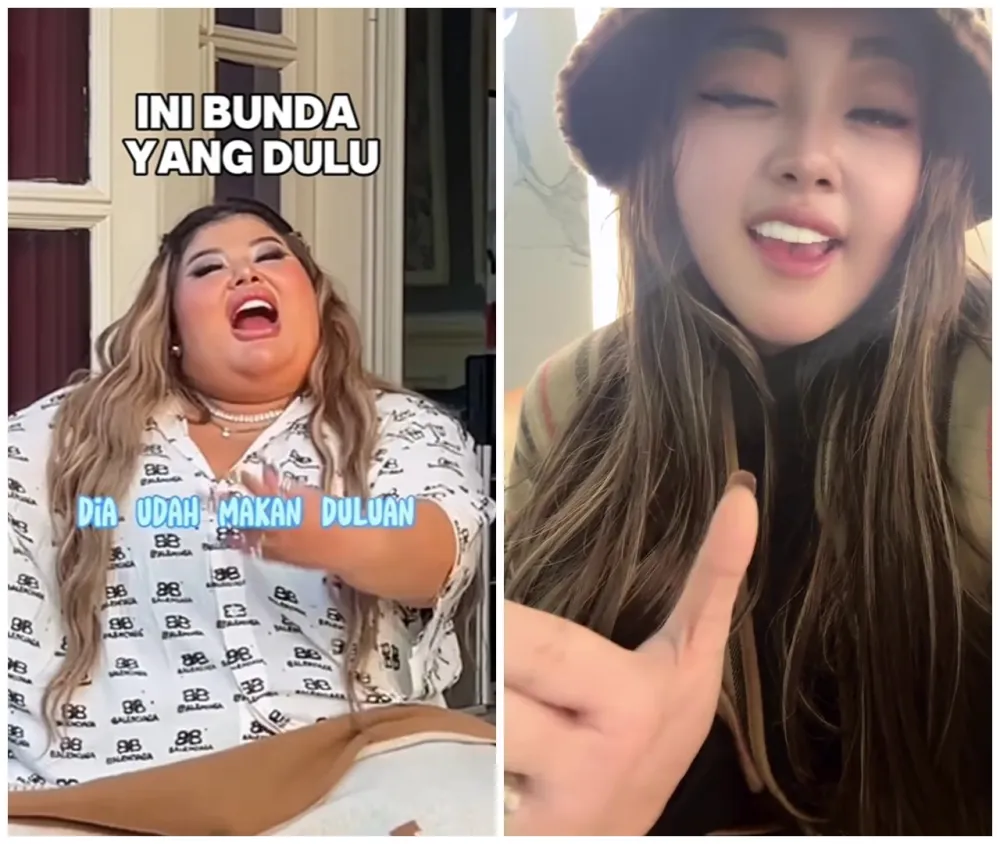 Shindy Samuel sebelum dan sesudah operasi plastik © Instagram Shindy Samuel sebelum dan sesudah operasi plastik © Instagram