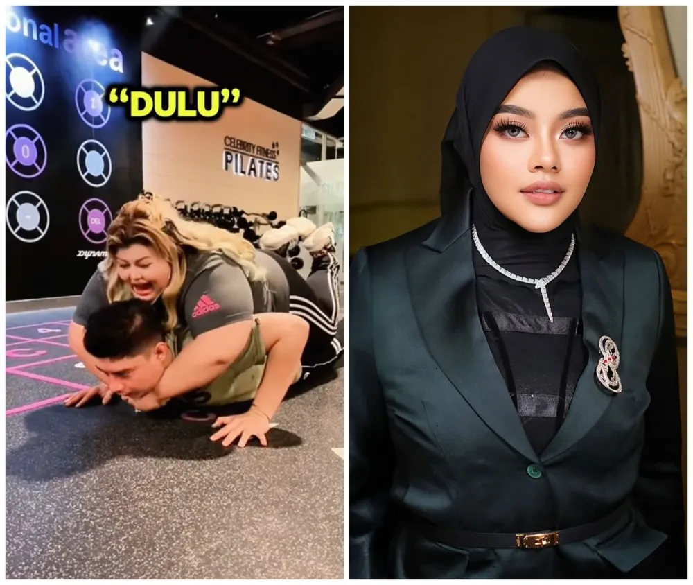 Shindy Samuel sebelum dan sesudah operasi plastik © Instagram Shindy Samuel sebelum dan sesudah operasi plastik © Instagram