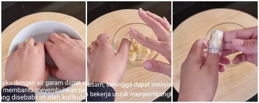 Jamur di kuku hilang dalam seminggu © YouTube
