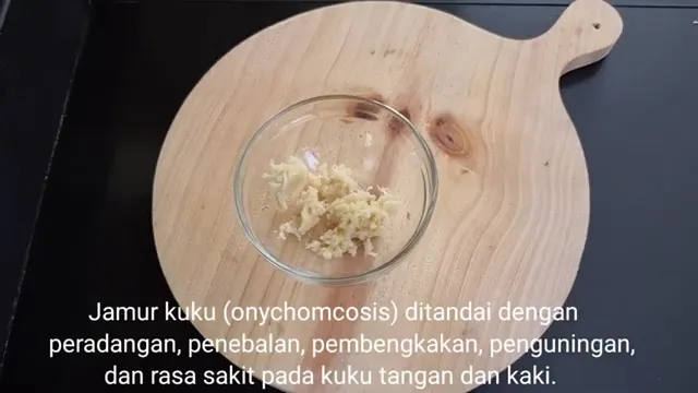 Jamur di kuku hilang dalam seminggu © YouTube