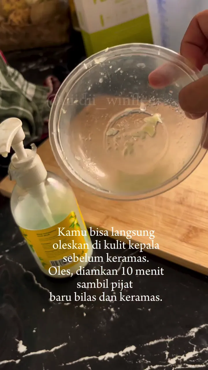 Cara membasmi ketombe © Instagram Cara membasmi ketombe © Instagram