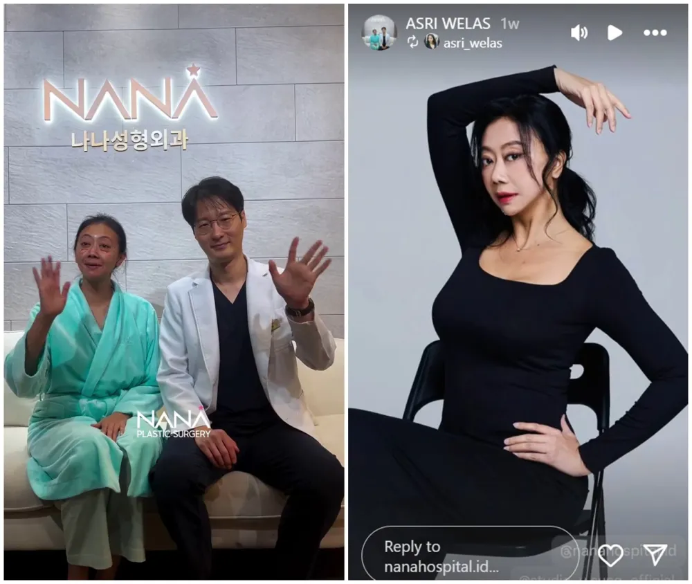 before-after Asri Welas © Instagram before-after Asri Welas © Instagram