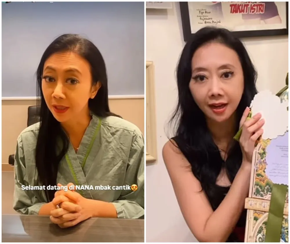 before-after Asri Welas © Instagram before-after Asri Welas © Instagram