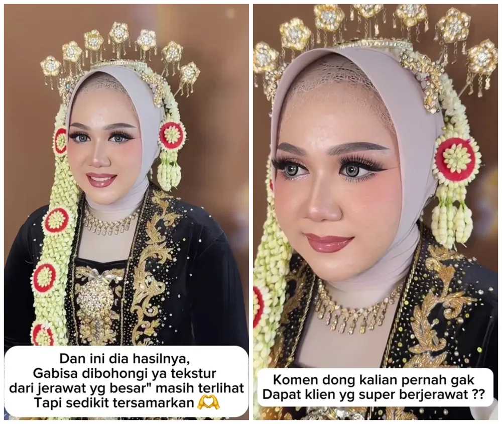Transformasi makeup wanita berjerawat © TikTok Transformasi makeup wanita berjerawat © TikTok