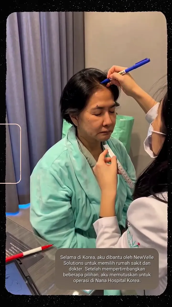 Yurike Prastika jalani operasi antiaging © Instagram