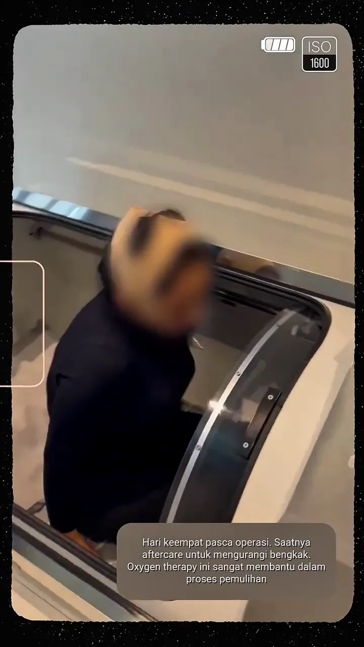 Yurike Prastika jalani operasi antiaging © Instagram