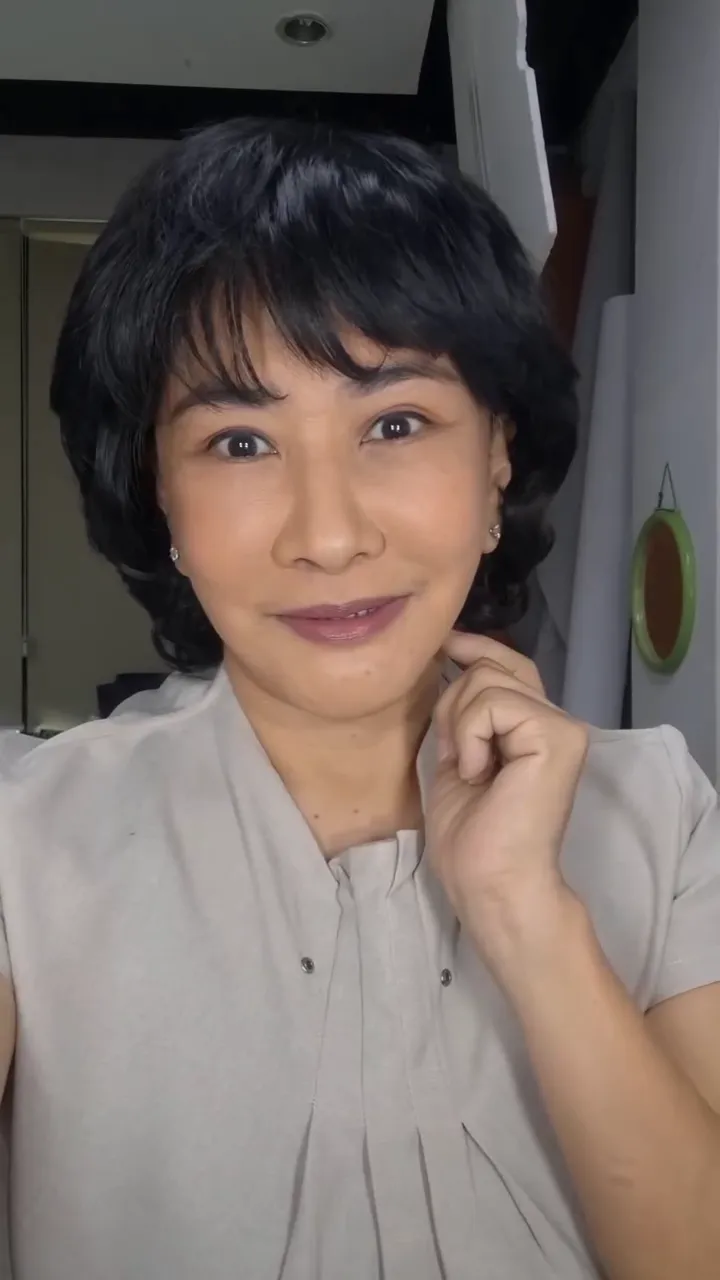 Yurike Prastika jalani operasi antiaging © Instagram