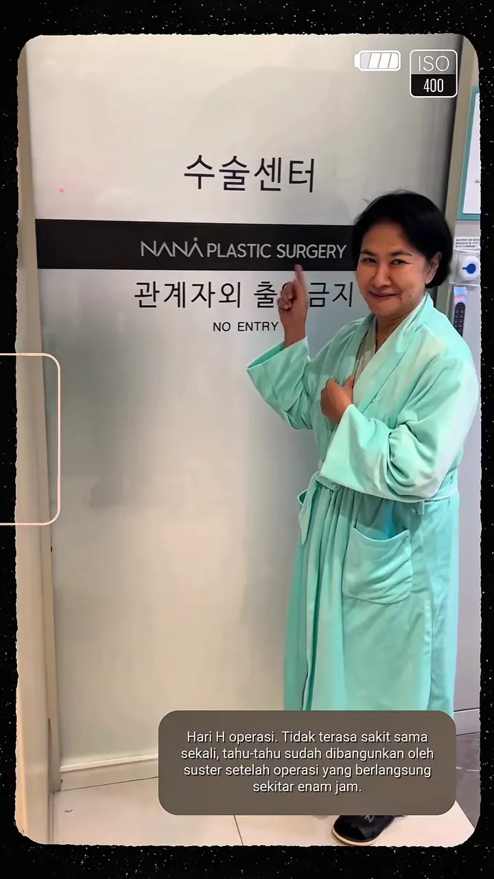 Yurike Prastika jalani operasi antiaging © Instagram