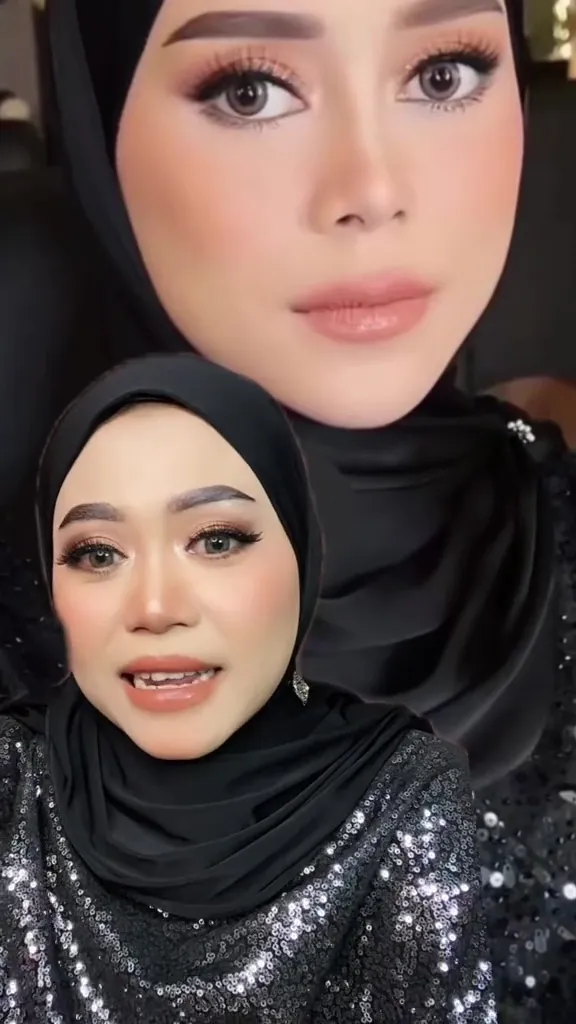 Mulanya punya kantung mata besar © TikTok