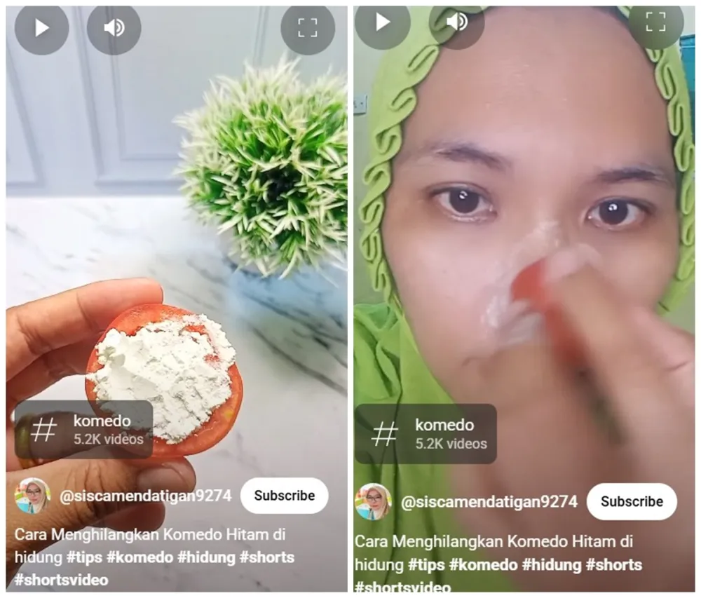 cara basmi komedo bikin pori-pori mengecil © YouTube
