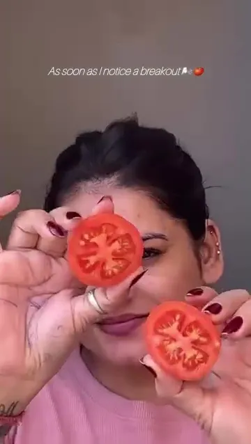 Wajah breakout jadi lebih mulus © Instagram