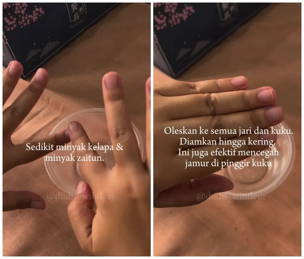 Kuku sering patah dan jamuran © Instagram