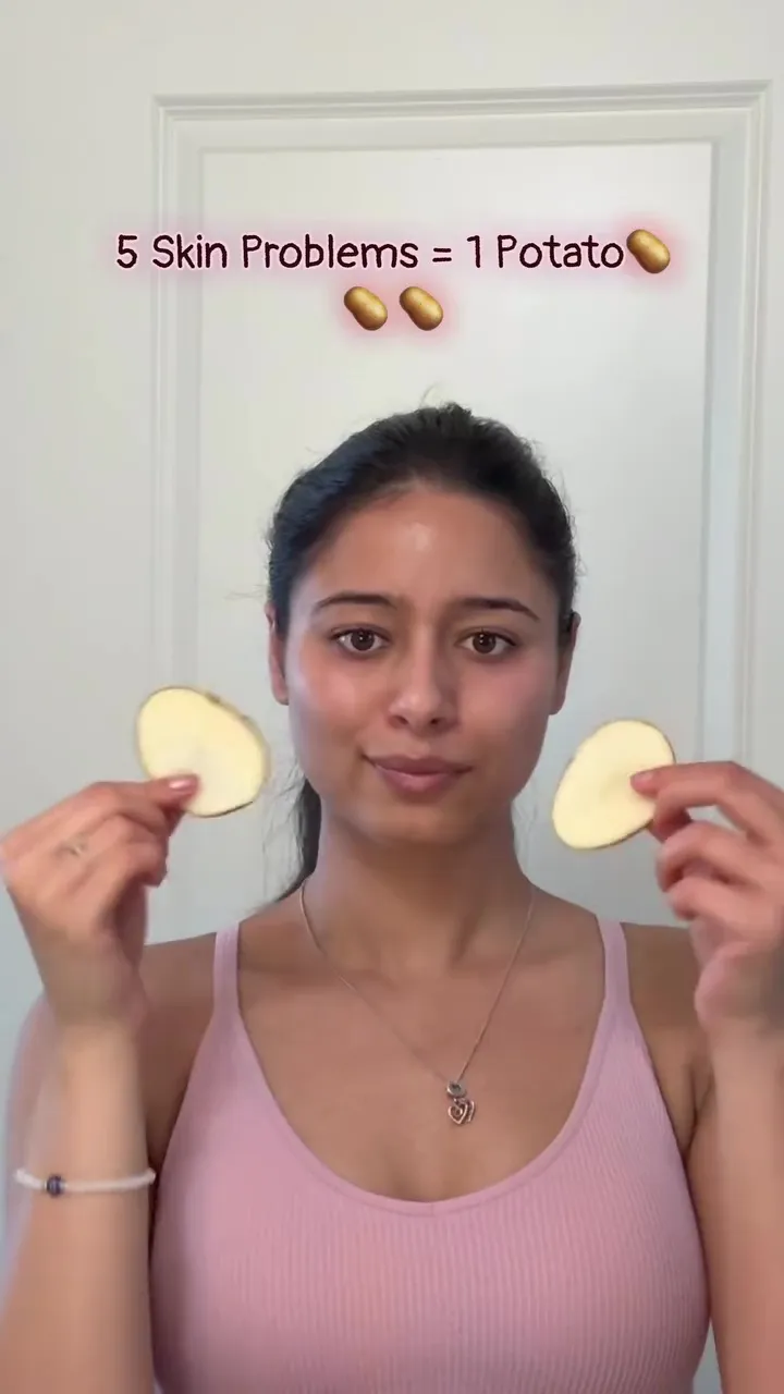 Cara baru hilangkan flek hitam © Instagram