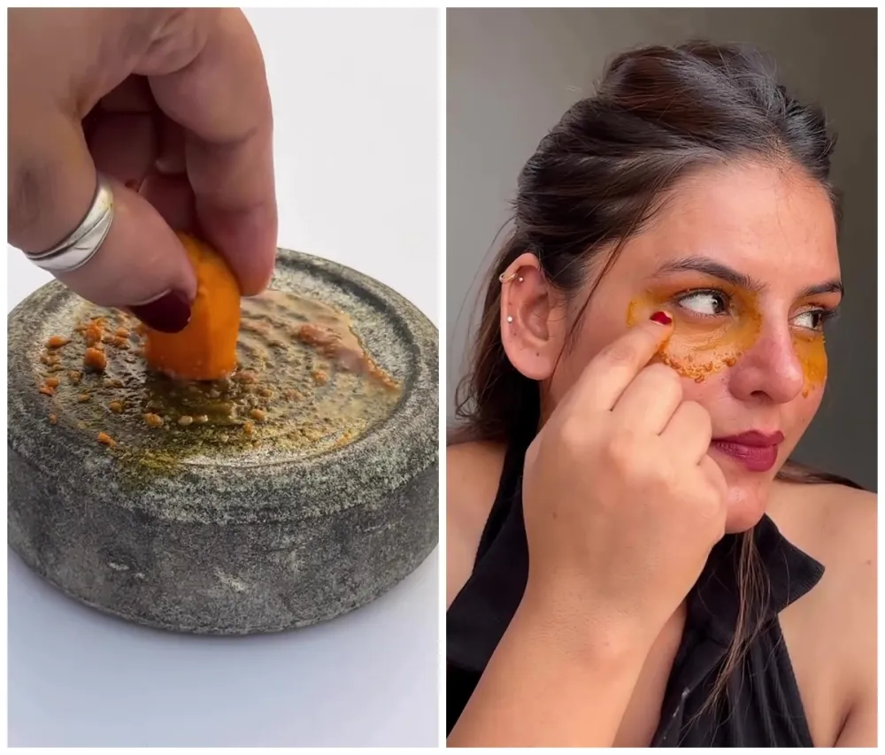 Cara hilangkan garis halus dan lingkaran hitam © Instagram