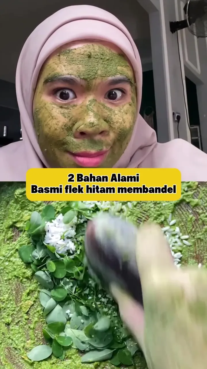 Flek hitam di wajah susah hilang © Instagram 