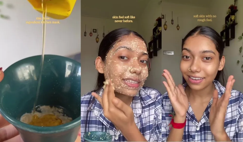 cara efektif hilangkan tiny bumps © Instagram cara efektif hilangkan tiny bumps © Instagram