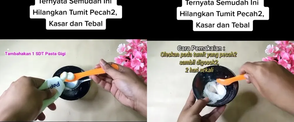 Solusi rumahan atasi tumit kasar © TikTok