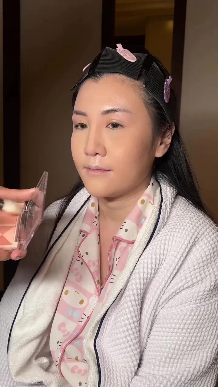 Punya bekas memar di wajah © Instagram Punya bekas memar di wajah © Instagram