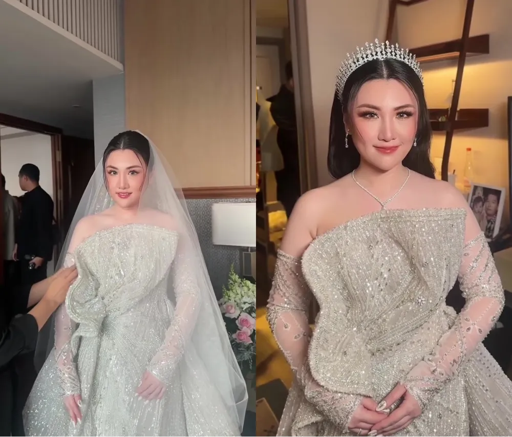 Punya bekas memar di wajah © Instagram Punya bekas memar di wajah © Instagram