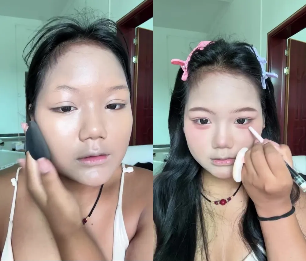 Cewek berwajah bulat ini auto jadi tirus © Instagram Cewek berwajah bulat ini auto jadi tirus © Instagram