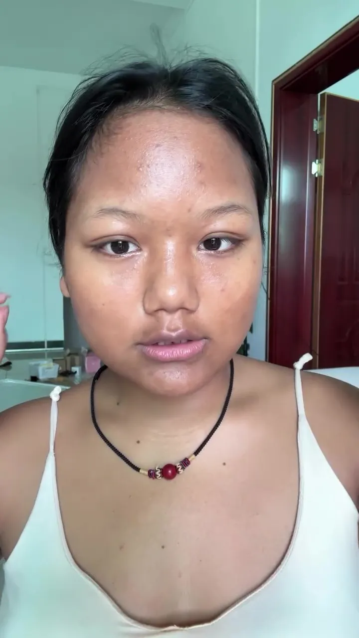 Cewek berwajah bulat ini auto jadi tirus © Instagram Cewek berwajah bulat ini auto jadi tirus © Instagram