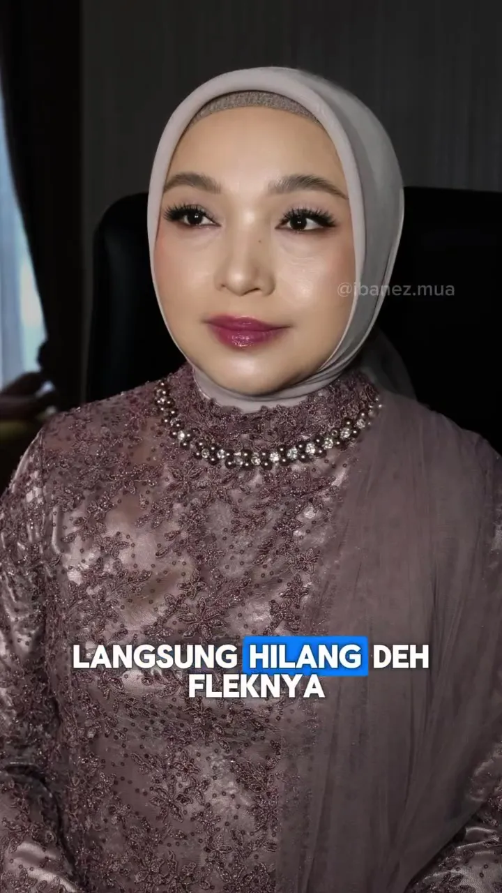 Flek hitam ter-cover © Instagram