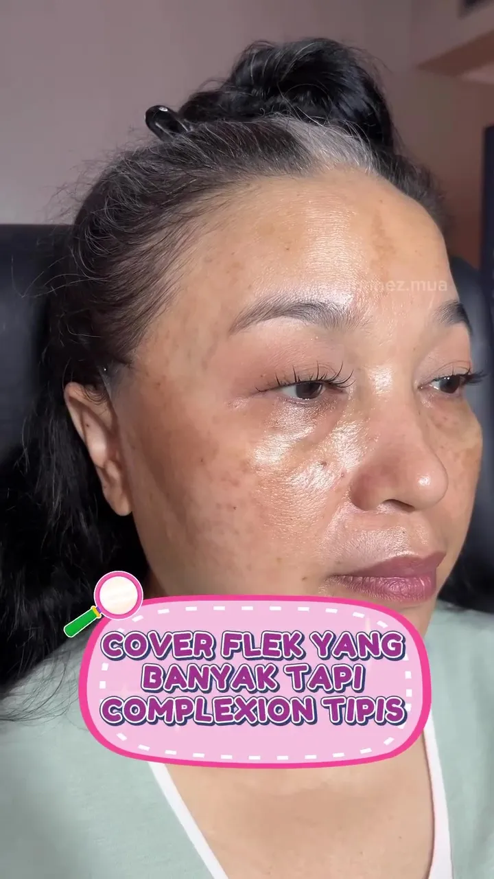 Flek hitam ter-cover © Instagram