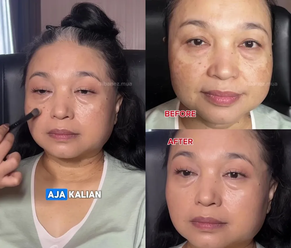 Flek hitam ter-cover © Instagram