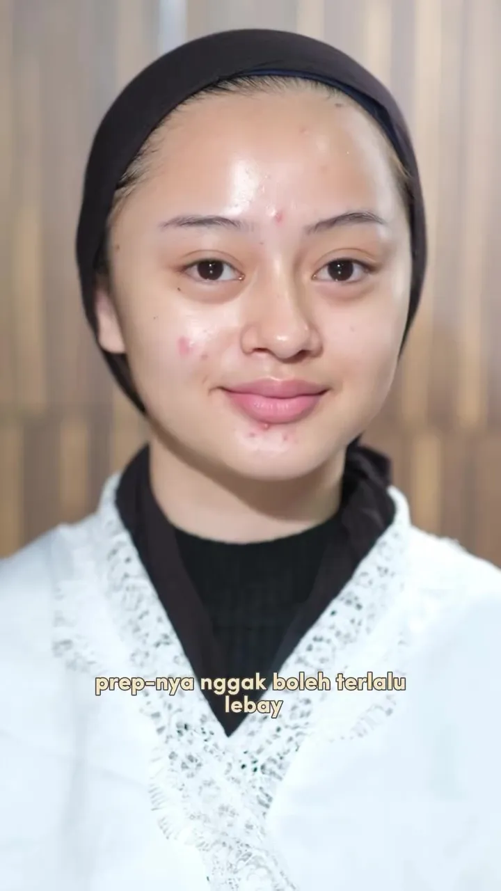 Punya jerawat aktif © Instagram