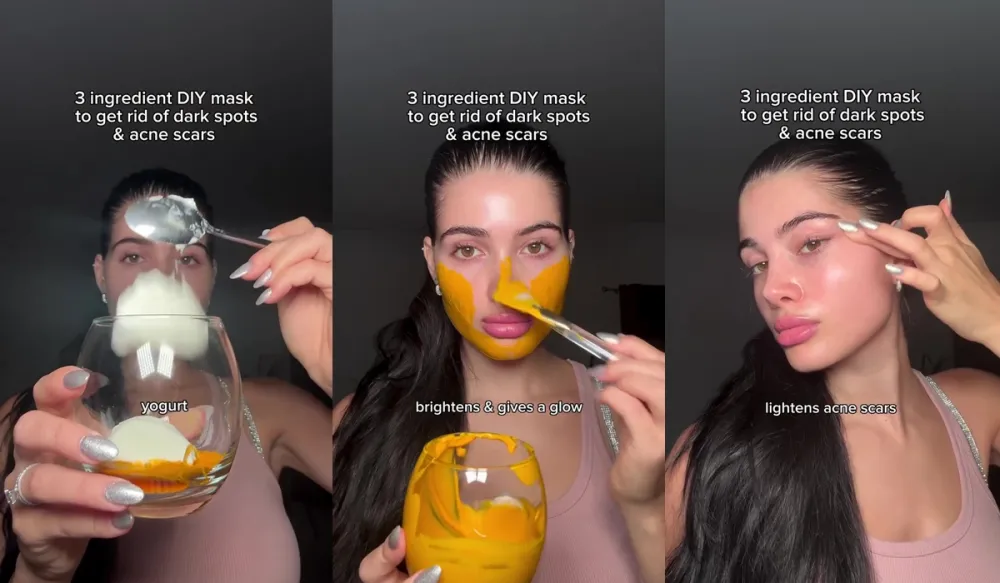 Tak perlu laser jutaan rupiah © Instagram 